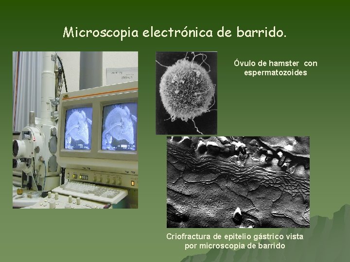 Microscopia electrónica de barrido. Óvulo de hamster con espermatozoides Criofractura de epitelio gástrico vista