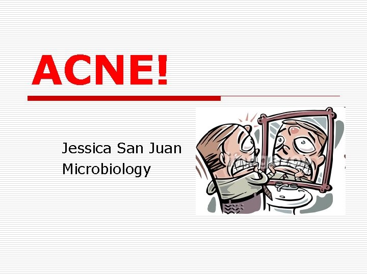 ACNE! Jessica San Juan Microbiology 