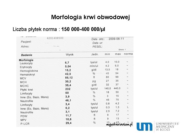 Morfologia krwi obwodowej Liczba płytek norma : 150 000 -400 000/μl 