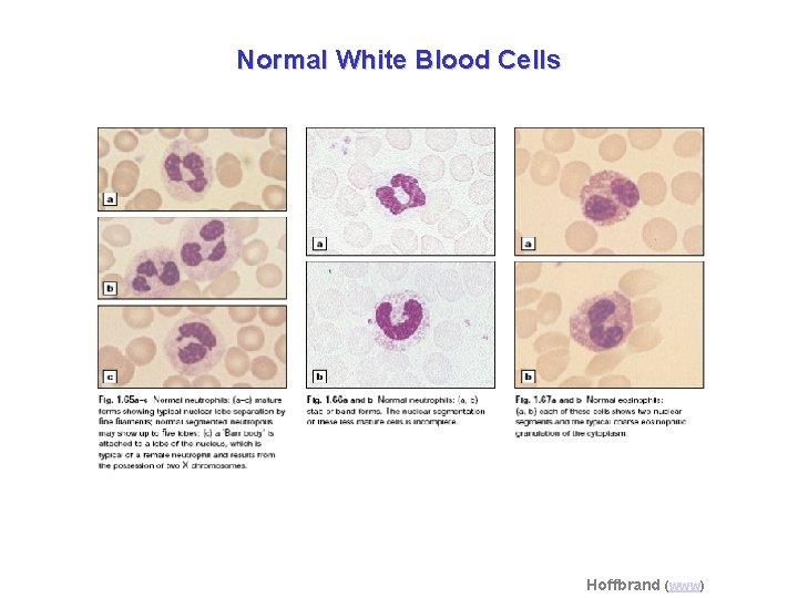 Normal White Blood Cells Hoffbrand (www) 