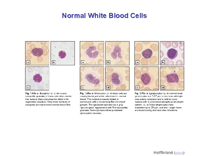 Normal White Blood Cells Hoffbrand (www) 