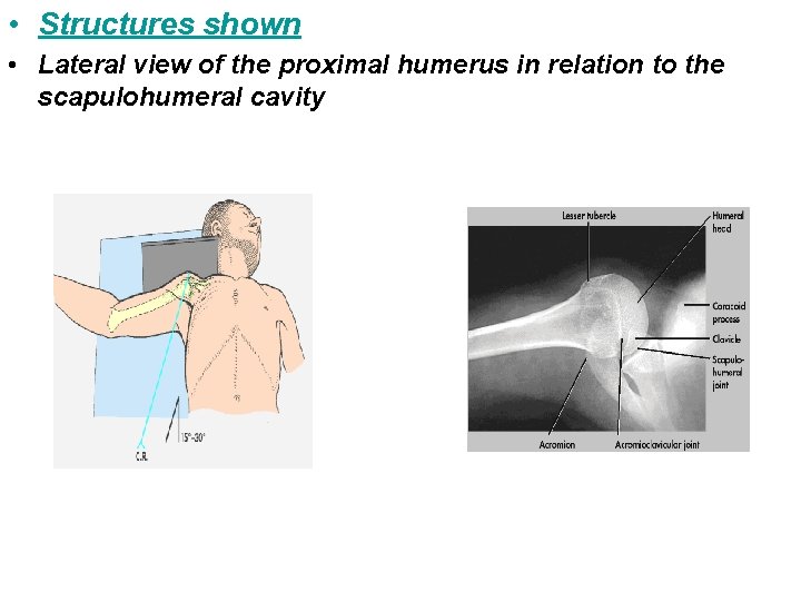  • Structures shown • Lateral view of the proximal humerus in relation to