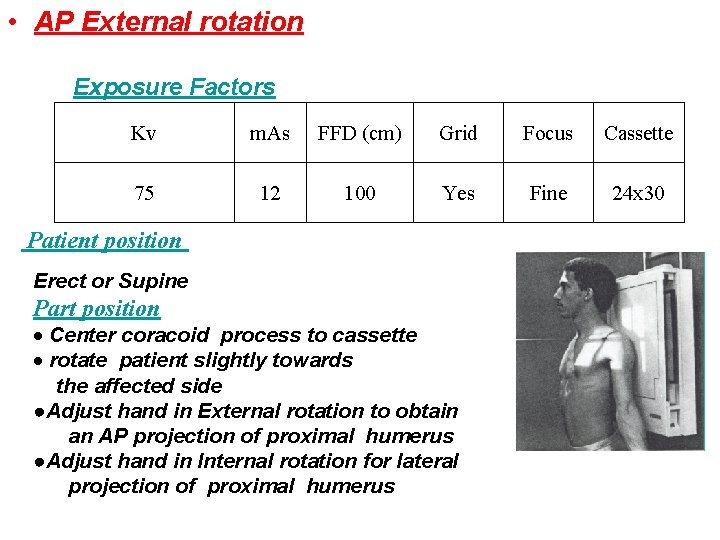  • AP External rotation Exposure Factors Kv m. As FFD (cm) Grid Focus