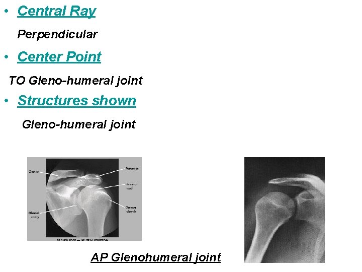  • Central Ray Perpendicular • Center Point TO Gleno-humeral joint • Structures shown