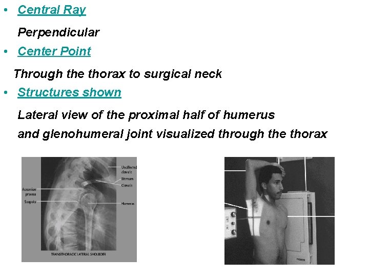  • Central Ray Perpendicular • Center Point Through the thorax to surgical neck