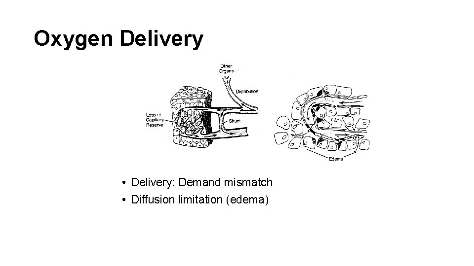 Oxygen Delivery • Delivery: Demand mismatch • Diffusion limitation (edema) 