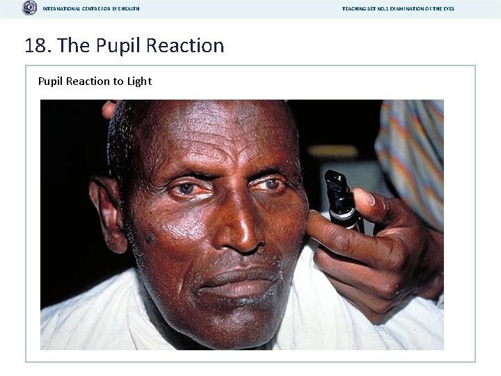 INTERNATIONAL CENTRE FOR EYE HEALTH 18. The Pupil Reaction to Light TEACHING SET NO.