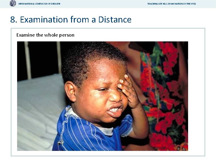 INTERNATIONAL CENTRE FOR EYE HEALTH 8. Examination from a Distance Examine the whole person