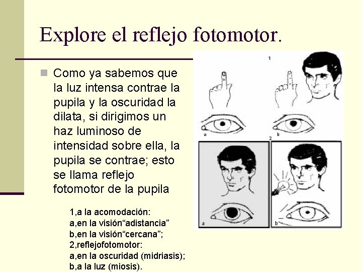 Explore el reflejo fotomotor. n Como ya sabemos que la luz intensa contrae la Explore el reflejo fotomotor. n Como ya sabemos que la luz intensa contrae la