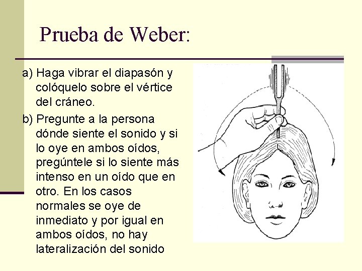 Prueba de Weber: a) Haga vibrar el diapasón y colóquelo sobre el vértice del Prueba de Weber: a) Haga vibrar el diapasón y colóquelo sobre el vértice del