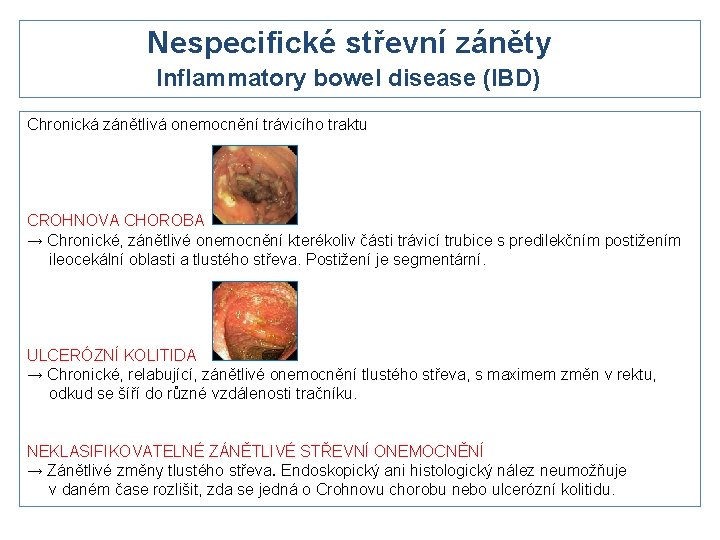 Nespecifické střevní záněty Inflammatory bowel disease (IBD) Chronická zánětlivá onemocnění trávicího traktu CROHNOVA CHOROBA