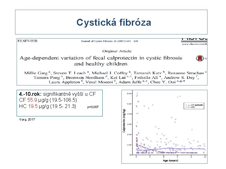 Cystická fibróza 4. -10. rok: signifikantně vyšší u CF CF 55. 9 µg/g (19.