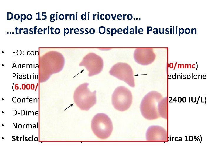 Dopo 15 giorni di ricovero… …trasferito presso Ospedale Pausilipon • EO: condizioni generali stazionarie
