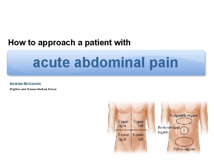 How to approach a patient with acute abdominal pain Andrew Mc. Govern Brighton and