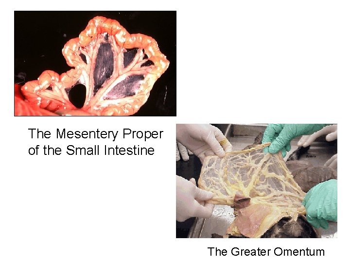 The Mesentery Proper of the Small Intestine The Greater Omentum 