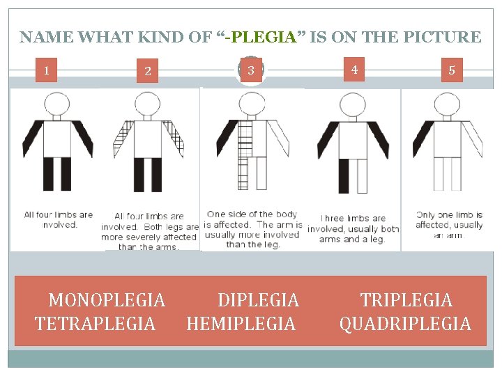NAME WHAT KIND OF “-PLEGIA” IS ON THE PICTURE 1 2 3 4 5 NAME WHAT KIND OF “-PLEGIA” IS ON THE PICTURE 1 2 3 4 5