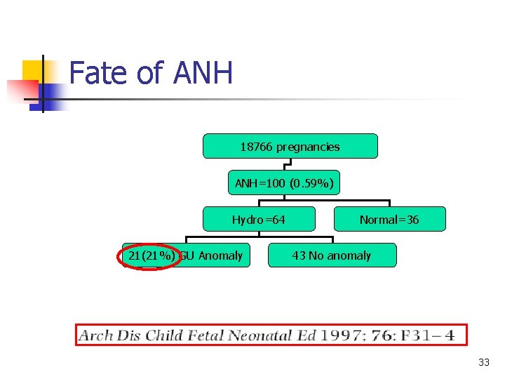 Fate of ANH 18766 pregnancies ANH=100 (0. 59%) Hydro=64 21(21%) GU Anomaly Normal=36 43
