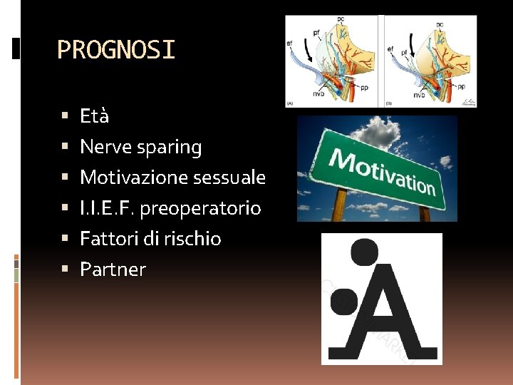 PROGNOSI Età Nerve sparing Motivazione sessuale I. I. E. F. preoperatorio Fattori di rischio
