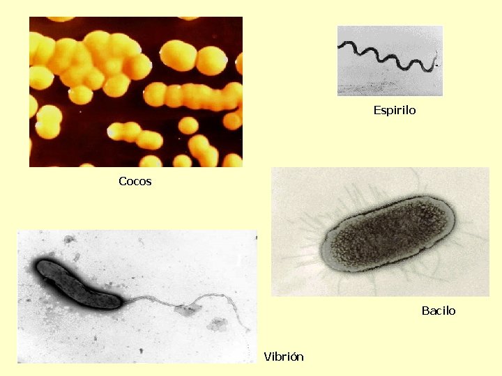 Espirilo Cocos Bacilo Vibrión 