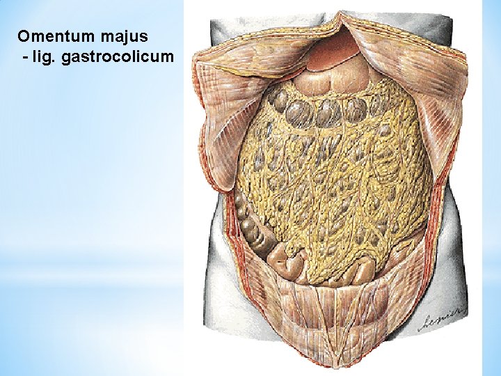 Omentum majus - lig. gastrocolicum 