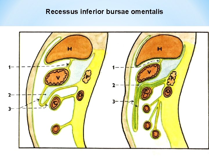 Recessus inferior bursae omentalis 