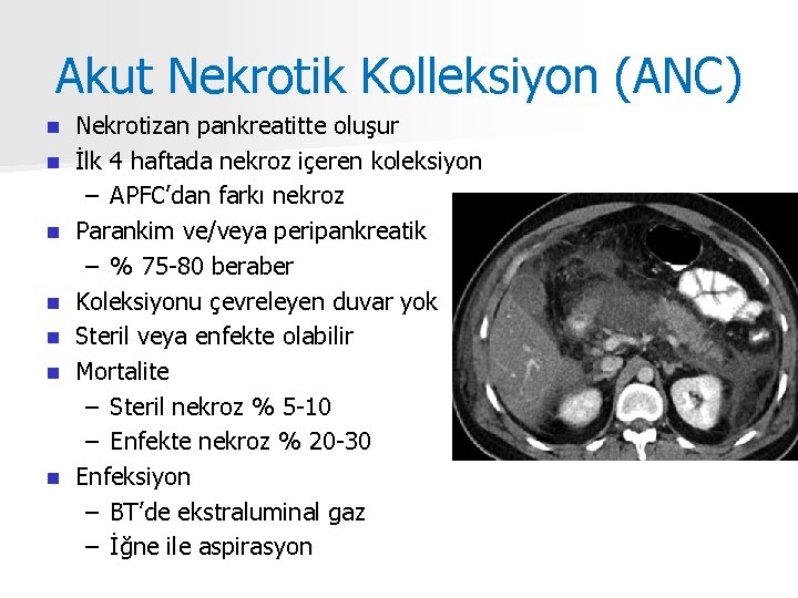 Akut Nekrotik Kolleksiyon (ANC) n n n n Nekrotizan pankreatitte oluşur İlk 4 haftada