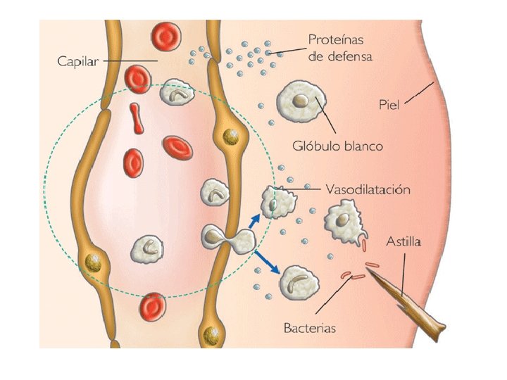 INFLAMAC ION Inflamacin Respuesta protectora del organismo ante