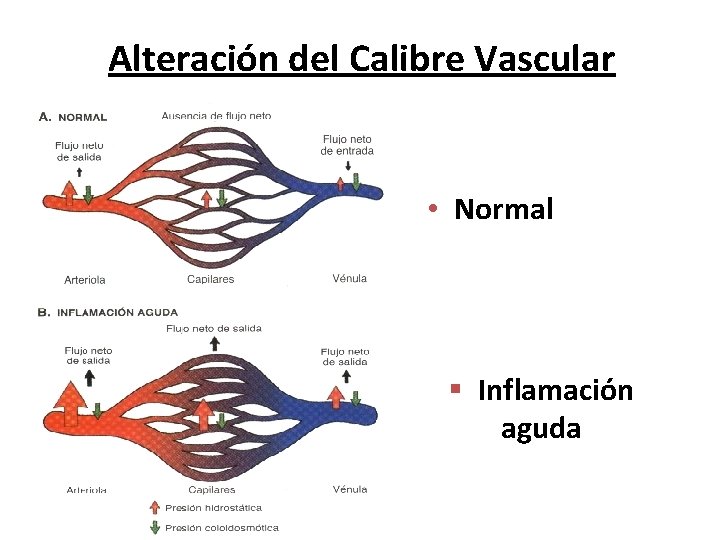 Alteración del Calibre Vascular • Normal § Inflamación aguda 