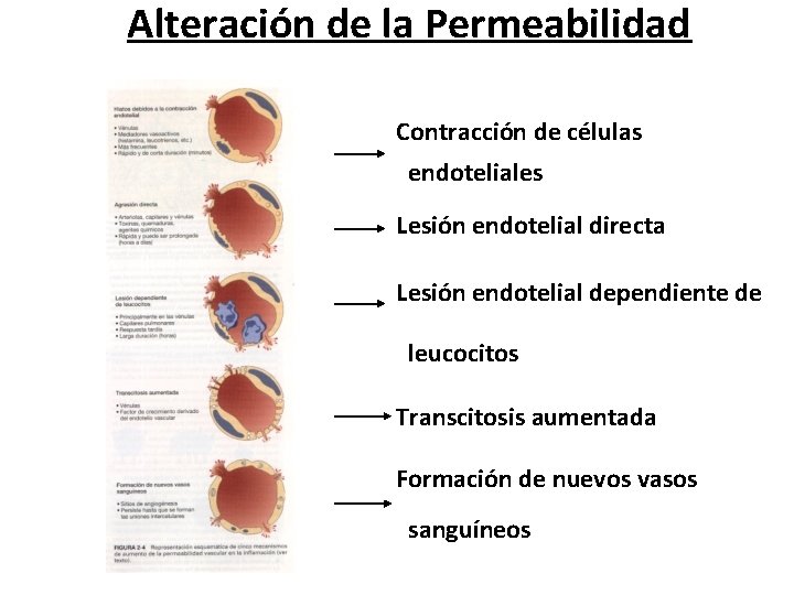 Alteración de la Permeabilidad Contracción de células endoteliales Lesión endotelial directa Lesión endotelial dependiente Alteración de la Permeabilidad Contracción de células endoteliales Lesión endotelial directa Lesión endotelial dependiente