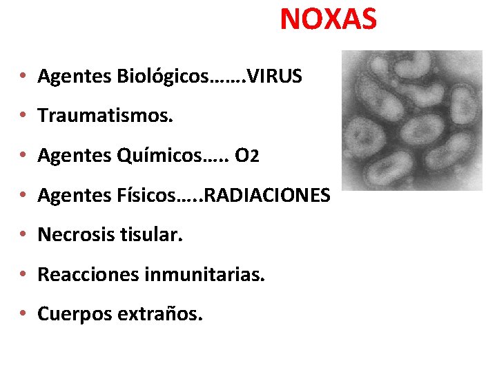 NOXAS • Agentes Biológicos……. VIRUS • Traumatismos. • Agentes Químicos…. . O 2 • NOXAS • Agentes Biológicos……. VIRUS • Traumatismos. • Agentes Químicos…. . O 2 •