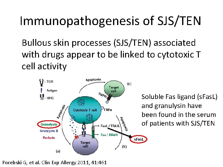 Immunopathogenesis of SJS/TEN Bullous skin processes (SJS/TEN) associated with drugs appear to be linked