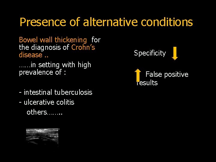 Presence of alternative conditions Bowel wall thickening for the diagnosis of Crohn’s disease. .