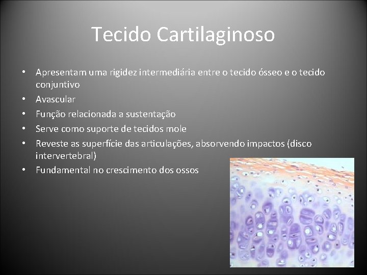 Tecido Cartilaginoso • Apresentam uma rigidez intermediária entre o tecido ósseo e o tecido Tecido Cartilaginoso • Apresentam uma rigidez intermediária entre o tecido ósseo e o tecido