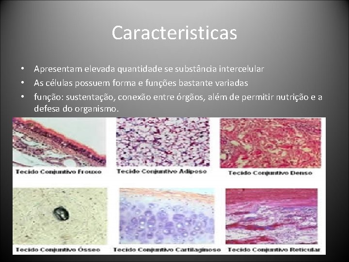 Caracteristicas • Apresentam elevada quantidade se substância intercelular • As células possuem forma e Caracteristicas • Apresentam elevada quantidade se substância intercelular • As células possuem forma e