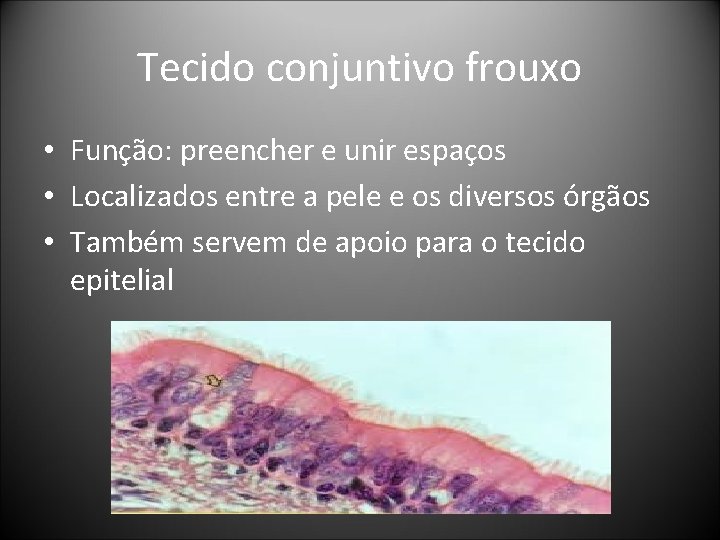 Tecido conjuntivo frouxo • Função: preencher e unir espaços • Localizados entre a pele Tecido conjuntivo frouxo • Função: preencher e unir espaços • Localizados entre a pele