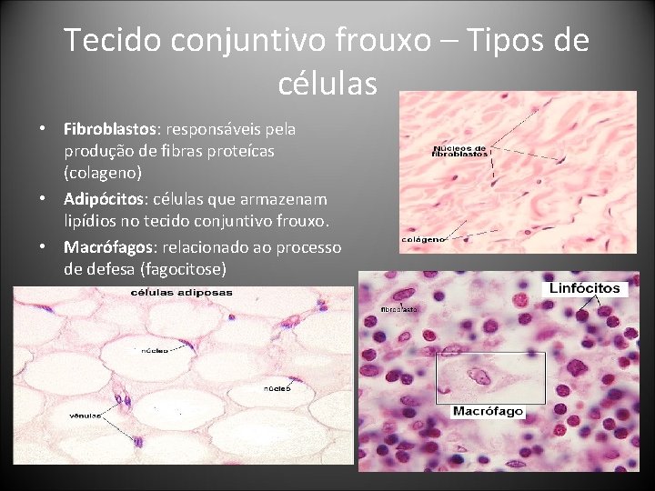Tecido conjuntivo frouxo – Tipos de células • Fibroblastos: responsáveis pela produção de fibras Tecido conjuntivo frouxo – Tipos de células • Fibroblastos: responsáveis pela produção de fibras
