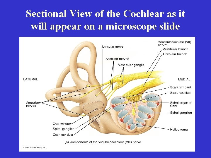 Sectional View of the Cochlear as it will appear on a microscope slide 
