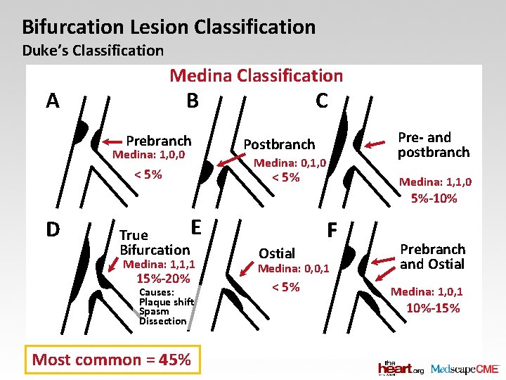 Bifurcation Lesion Classification Duke’s Classification Medina Classification A B Prebranch Medina: 1, 0, 0