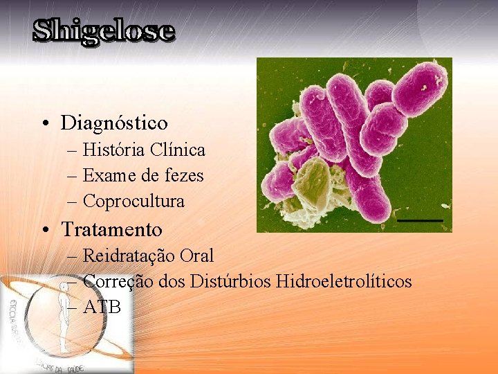  • Diagnóstico – História Clínica – Exame de fezes – Coprocultura • Tratamento