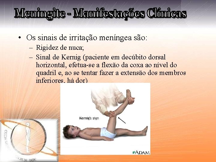  • Os sinais de irritação meníngea são: – Rigidez de nuca; – Sinal