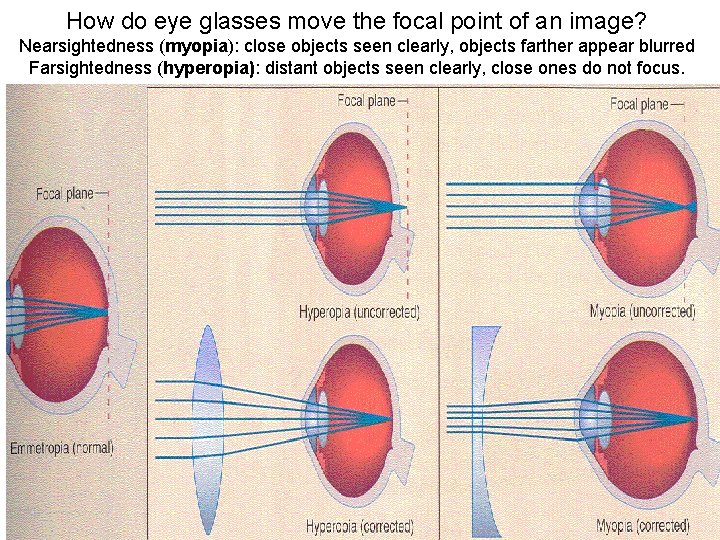 How do eye glasses move the focal point of an image? Nearsightedness (myopia): close