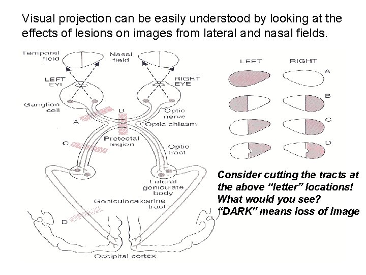 Visual projection can be easily understood by looking at the effects of lesions on