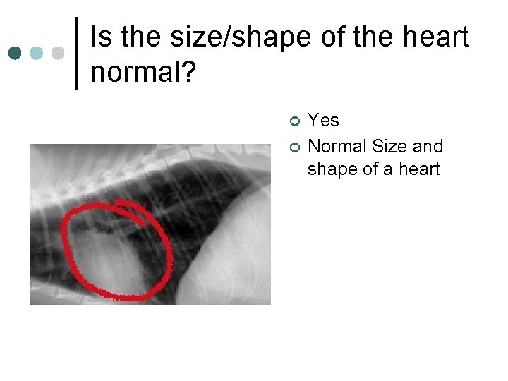 Is the size/shape of the heart normal? ¢ ¢ Yes Normal Size and shape
