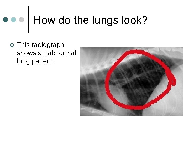 How do the lungs look? ¢ This radiograph shows an abnormal lung pattern. 