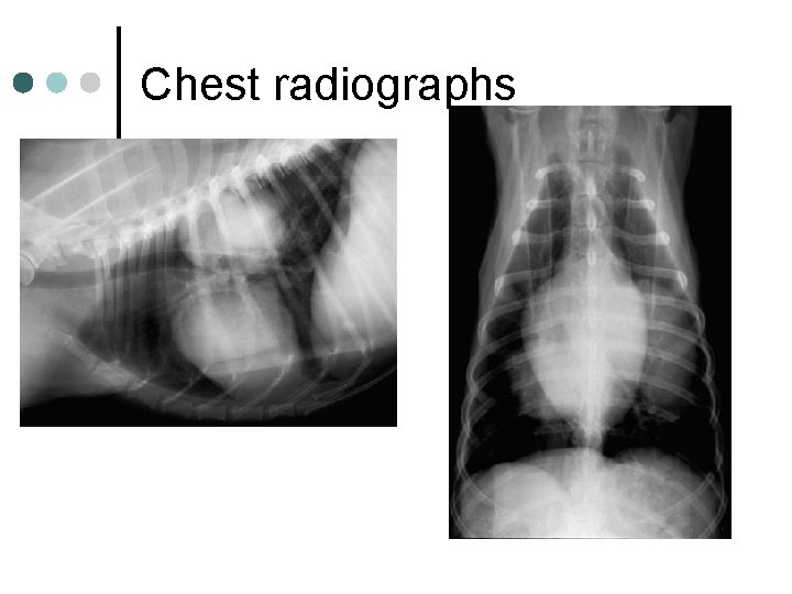 Chest radiographs 