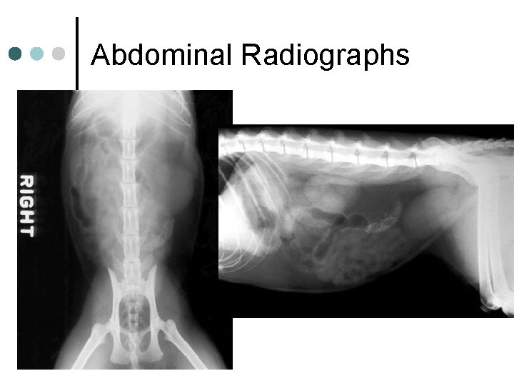 Abdominal Radiographs 