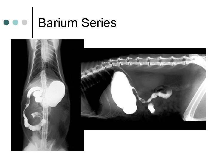 Barium Series 