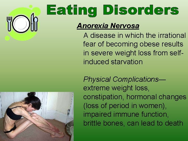 Anorexia Nervosa A disease in which the irrational fear of becoming obese results in