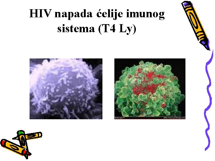 HIV napada ćelije imunog sistema (T 4 Ly) 