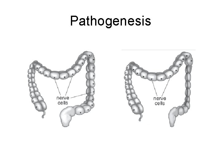 Pathogenesis 